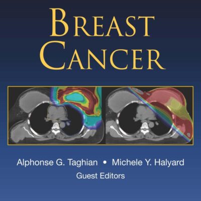 Breast Cancer (Radiation Medicine Rounds Book 3)