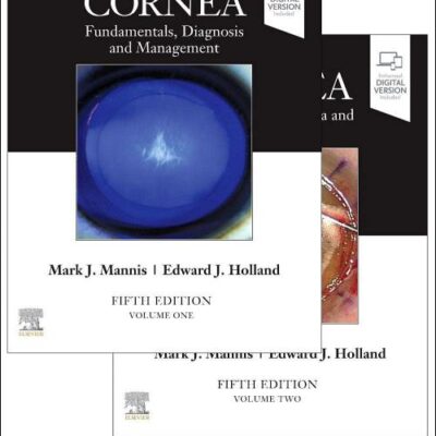 CORNEA