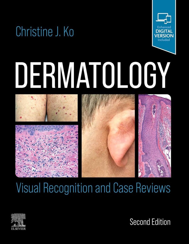 Dermatology Visual Recognition And Case Reviews 2Ed (Pb 2022)