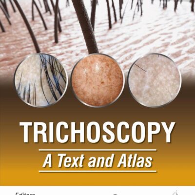 TRICHOSCOPY A TEXT AND ATLAS