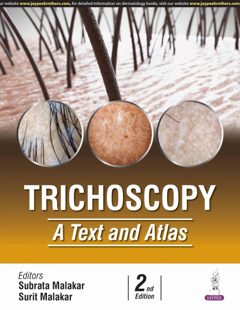 TRICHOSCOPY A TEXT AND ATLAS