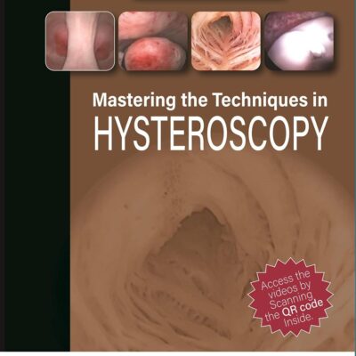 Mastering the Techniques in Hysteroscopy