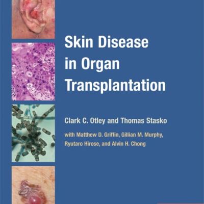 Skin Disease in ORgan Transplantation