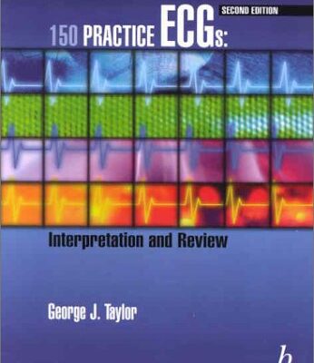 (EX)150 PRACTICE ECGS INTERPRETATION AND REVIEW