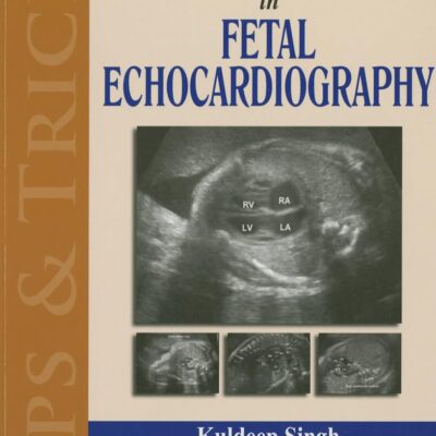 Tips & Tricks in Fetal Echocardiography