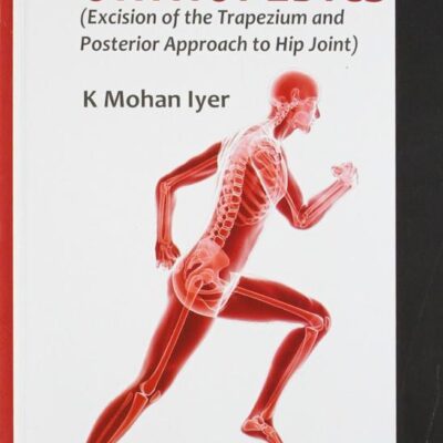 POCKET BOOK OF ORTHOPEDICS (EXCISION OF THE TRAPEZIUM AND POSTERIOR APPROACH TO HIP JOINT)
