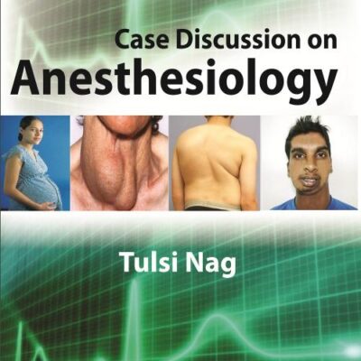 Case Discussion On Anesthesiology