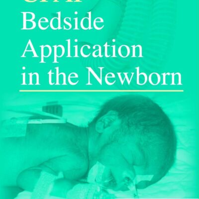 CPAP BEDSIDE APPLICATION IN THE NEWBORN