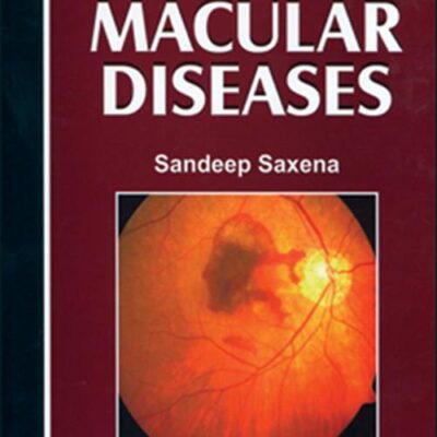 Focus on Macular Diseases with DVD-ROM