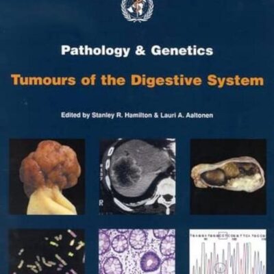 Pathology & Genetics Tumours Of The Digestive System: Pathology and Genetics of Tumours of the Digestive System (World Health Organization Classification of Tumours S.)