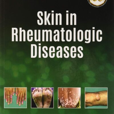 SKIN IN RHEUMATOLOGIC DISEASES
