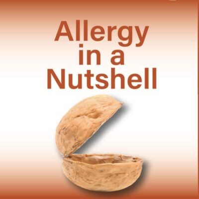 Allergy in a Nutshell: A Handbook