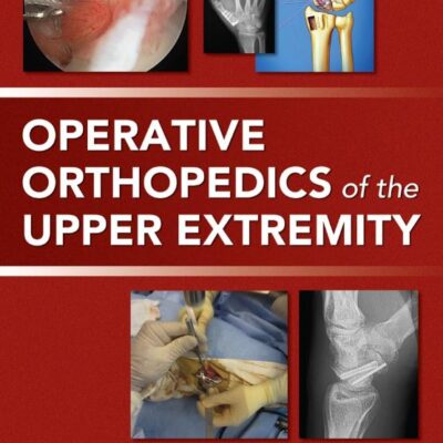 Operative Orthopedics Of The Upper Extremity (Hb 2014)