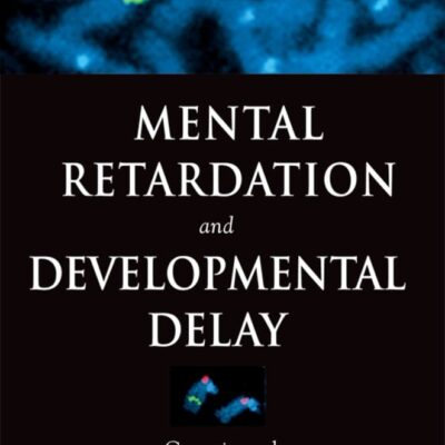 Mental Retardation and Developmental Delay: Genetic and Epigenetic Factors (Oxford Monographs on Medical Genetics)