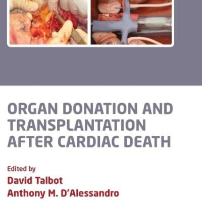 Organ Donation and Transplantation after Cardiac Death