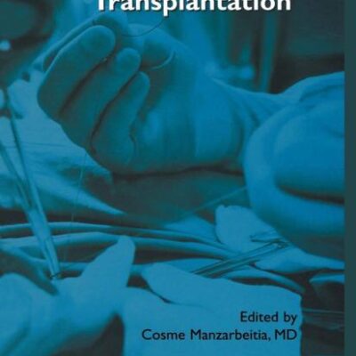 PRACTICAL MANUAL OF ABDOMINAL ORGAN TRANSPLANTATION