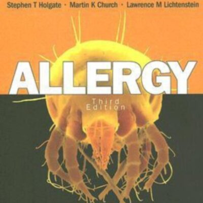 Allergy