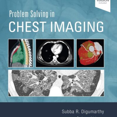 Problem Solving in Chest Imaging