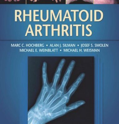 Rheumatoid Arthritis