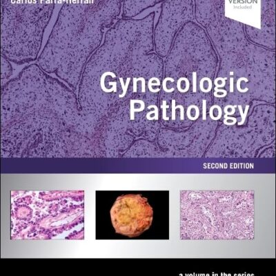 Gynecologic Pathology A Volume In Foundations In Diagnostic Pathology Series With Access Code 2Ed (Hb 2021)