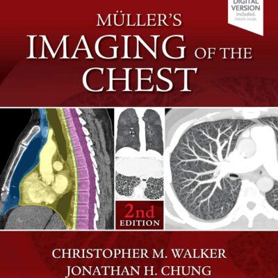 Mullers Imaging Of The Chest With Access Code 2Ed (Hb 2019): Expert Radiology Series
