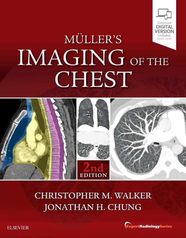 Mullers Imaging Of The Chest With Access Code 2Ed (Hb 2019): Expert Radiology Series