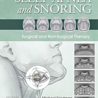 Sleep Apnea and Snoring -2E