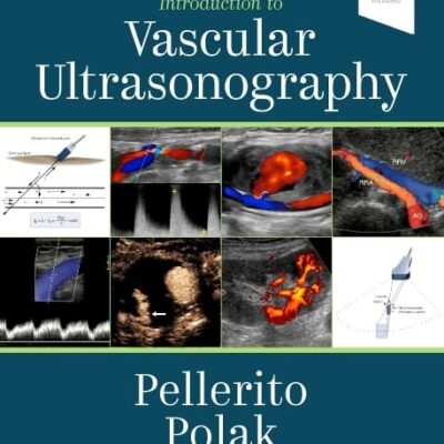 Introduction to Vascular Ultrasonography: Expert Consult - Online and Print