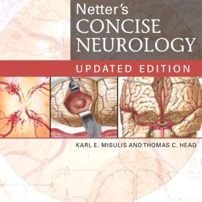 Netters Concise Neurology Updated Edition (Pb 2017) (Netter Clinical Science)
