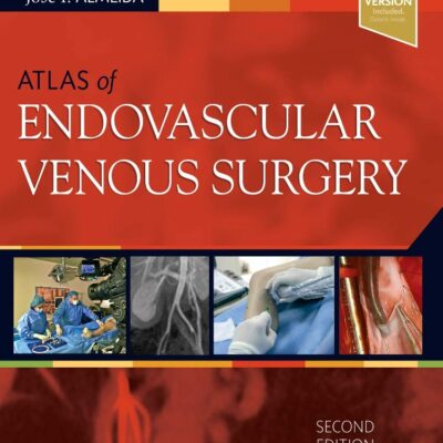 Atlas of Endovascular Venous Surgery: Expert Consult - Online and Print