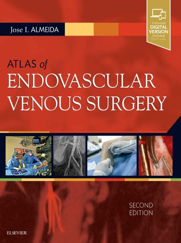 Atlas of Endovascular Venous Surgery Expert Consult 2nd Edition - Clinical reference textbook for vascular surgery procedures