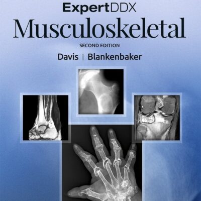 Expertddx Musculoskeletal 2Ed (Hb 2018)