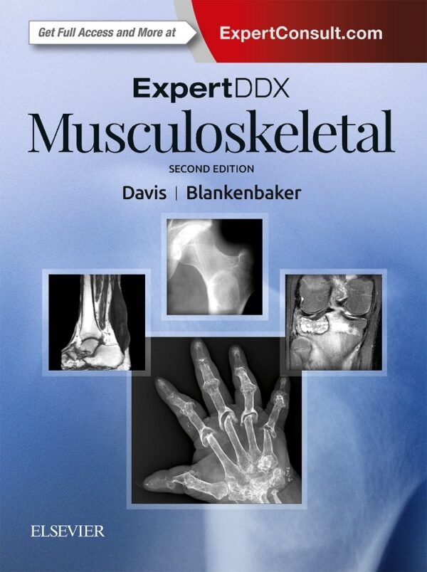 Expertddx Musculoskeletal 2Ed (Hb 2018)