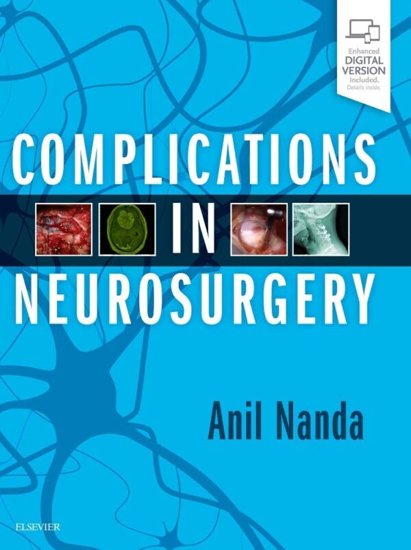 Complications in Neurosurgery - Elsevier neurosurgery textbook for managing surgical complications