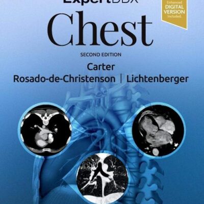 ExpertDDx: Chest