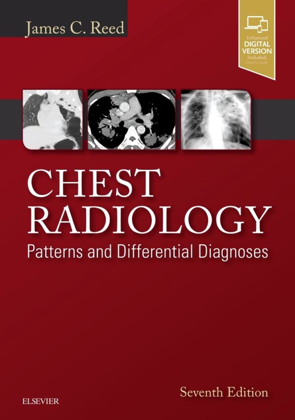 Chest Radiology Patterns and Differential Diagnoses 7th Edition by Benjamin Felson - Medical Textbook