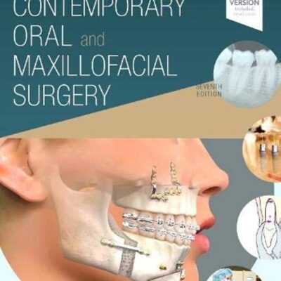 Contemporary Oral and Maxillofacial Surgery