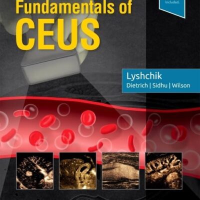 Specialty Imaging: Fundamentals of CEUS