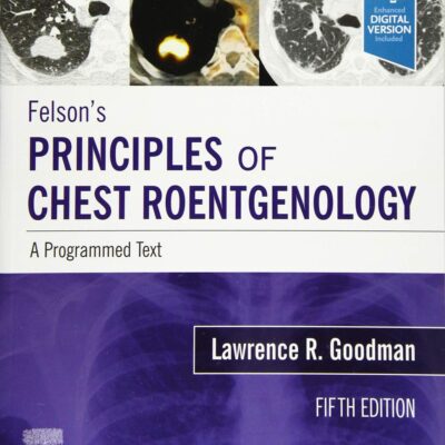 Felsons Principles Of Chest Roentgenology A Programmed Text With Access Code 5Ed (Pb 2021)