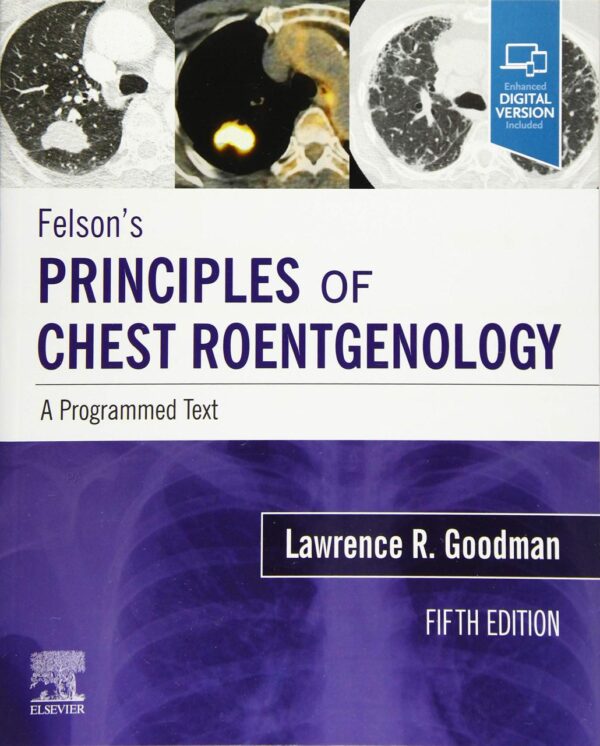 Felsons Principles Of Chest Roentgenology A Programmed Text With Access Code 5Ed (Pb 2021)