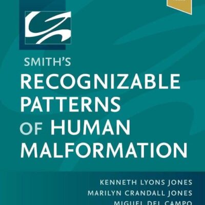 Smith'S Recognizable Patterns Of Human Malformation: Expert Consult - Online And Print