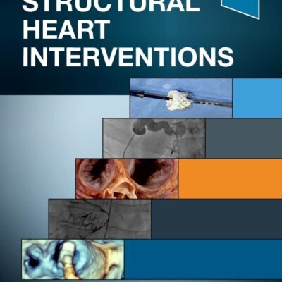 Handbook of Structural Heart Interventions