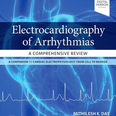 Electrocardiography Of Arrhythmias A Comprehensive Review 2Ed (Pb 2022)
