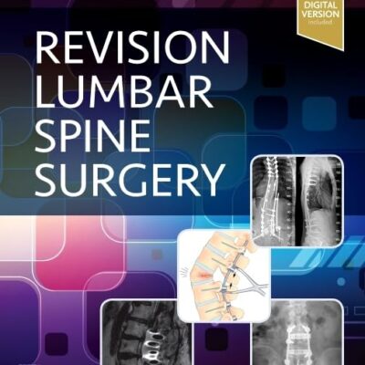 REVISION LUMBAR SPINE SURGERY (HB 2022)
