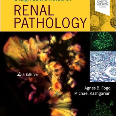 Diagnostic Atlas of Renal Pathology