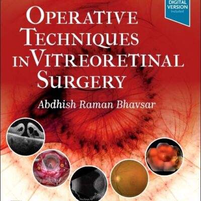 OPERATIVE TECHNIQUES IN VITREORETINAL SURGERY, 1ST EDITION
