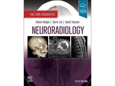 Neuroradiology: The Core Requisites