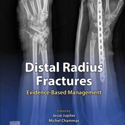 Distal Radius Fractures-1E: Evidence-Based Management