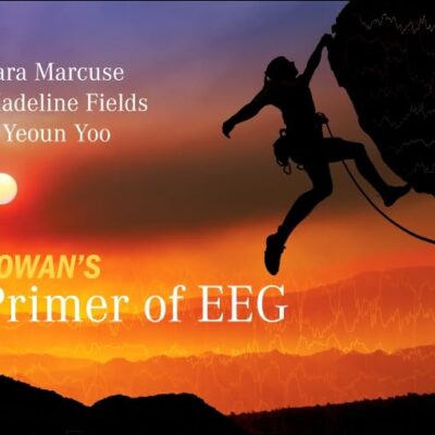 Rowan'S Primer Of Eeg