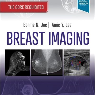 Breast Imaging-4E